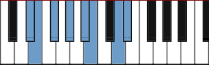 D# Neapolitan Minor scale diagram